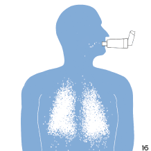 Inhalator med beh&aring;llare