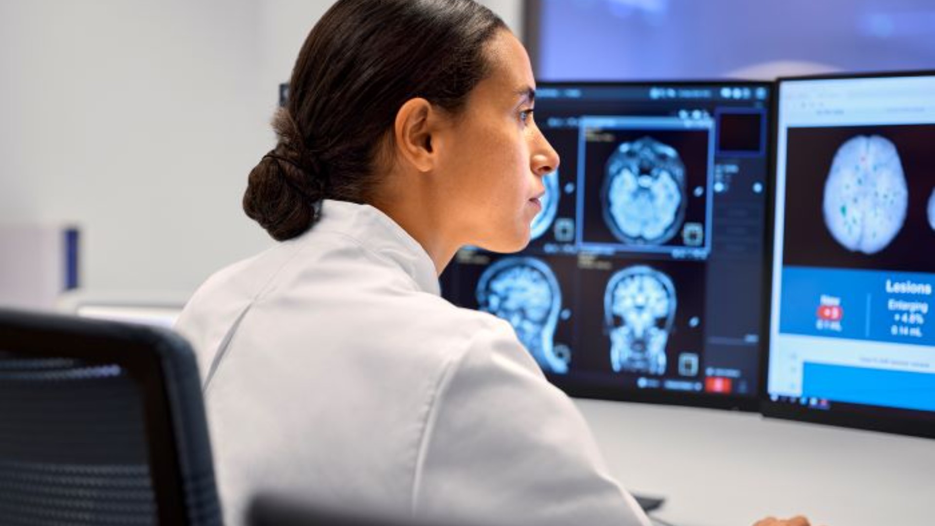 Philips AI Manager nu tillg&auml;nglig i hela Norge